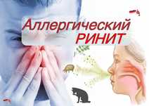 100%  выздоровление от Аллергического Ринита !!!