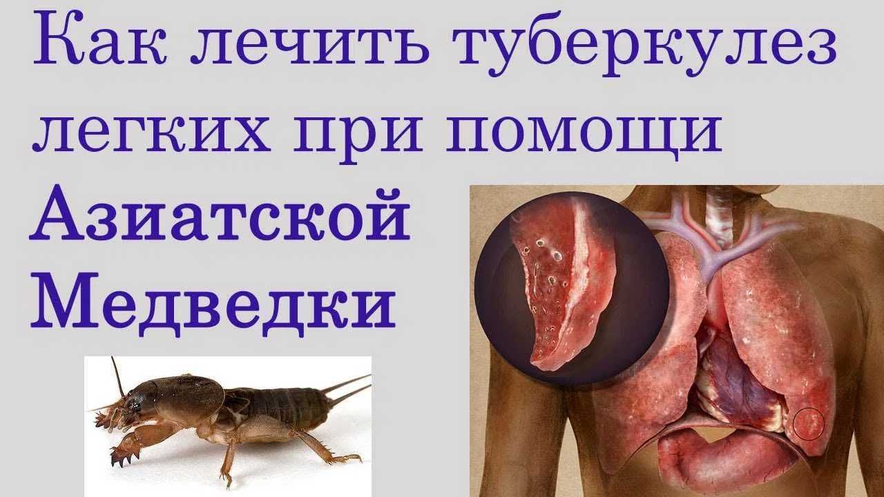 Медведка для лечения туберкулеза и пневмонии.