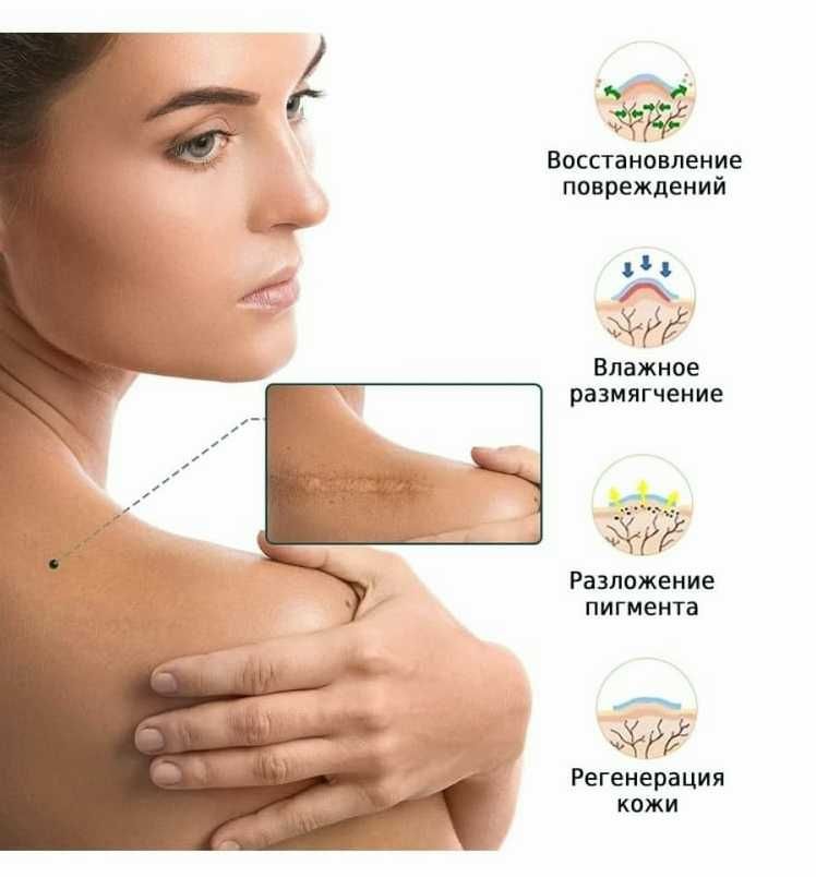 Лучший пластырь от шрамов, рубцов. Прост в применении