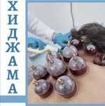Хиджама. Шертпе. Кровопускание.