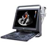 CHISON SonoBook 6 портативный УЗИ аппарат