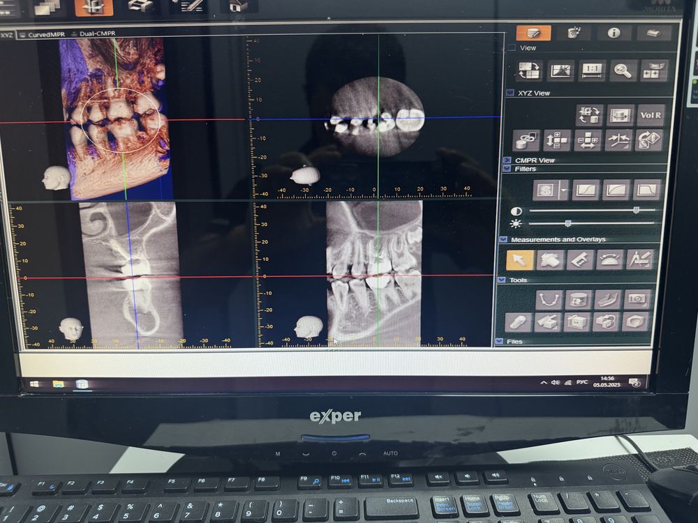 3D рентген Morita (Япония) стоматологический