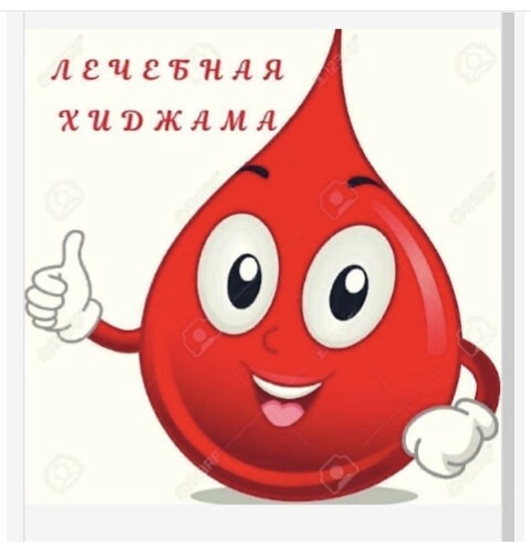 Пиявки хиджама