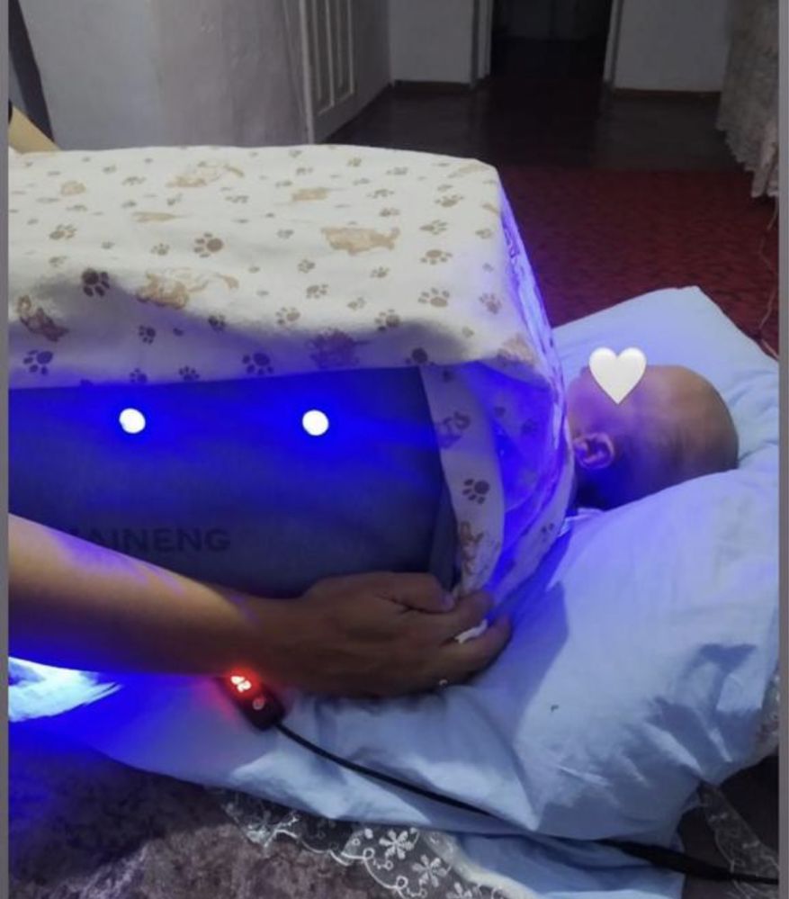 Фотолампа от желтушки 1000
