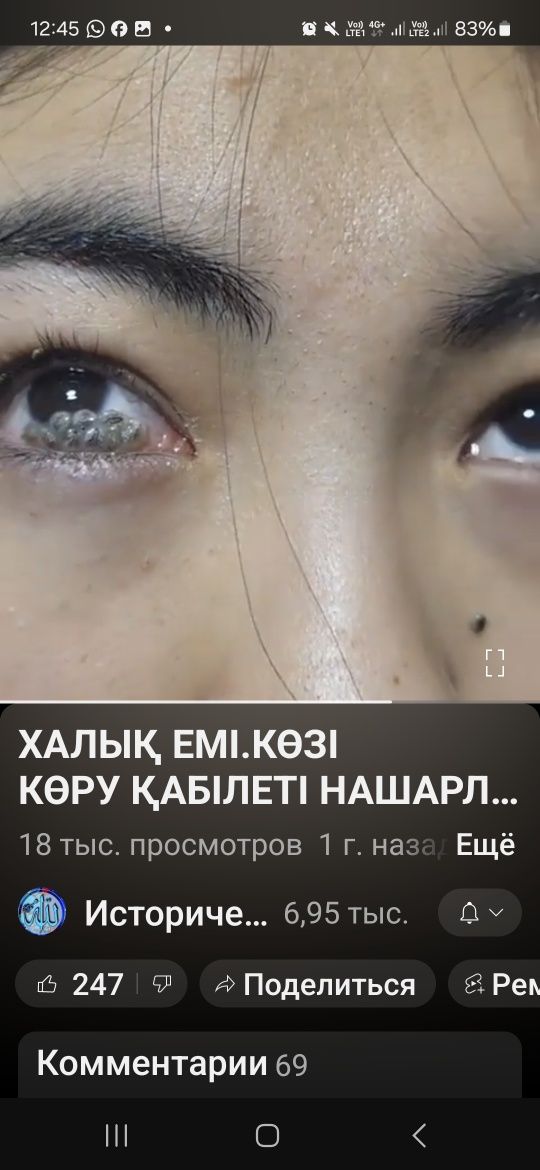 Орама дәні бес мың көз тазалаушы сатылымда