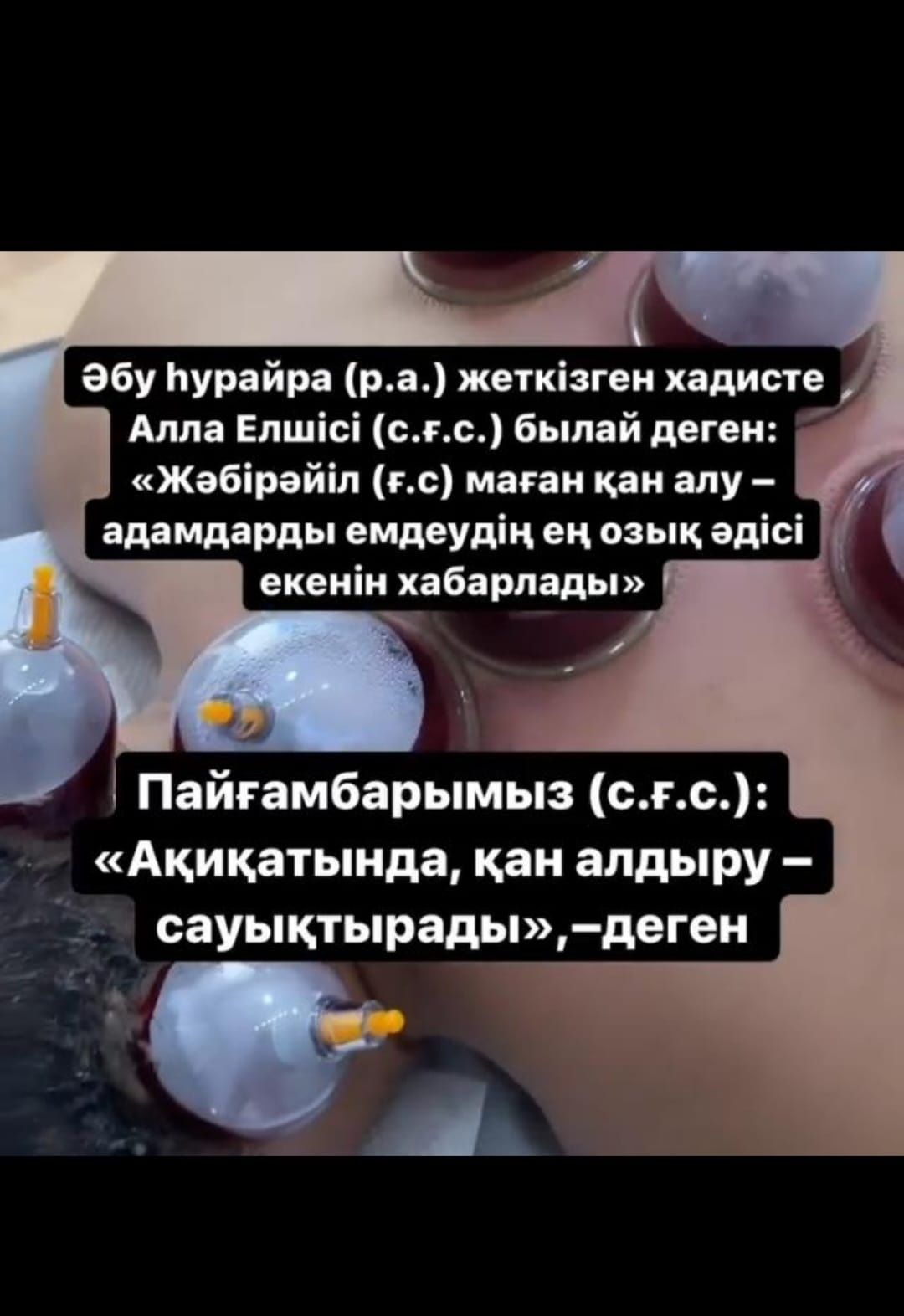 Хиджама Шымкент!!!