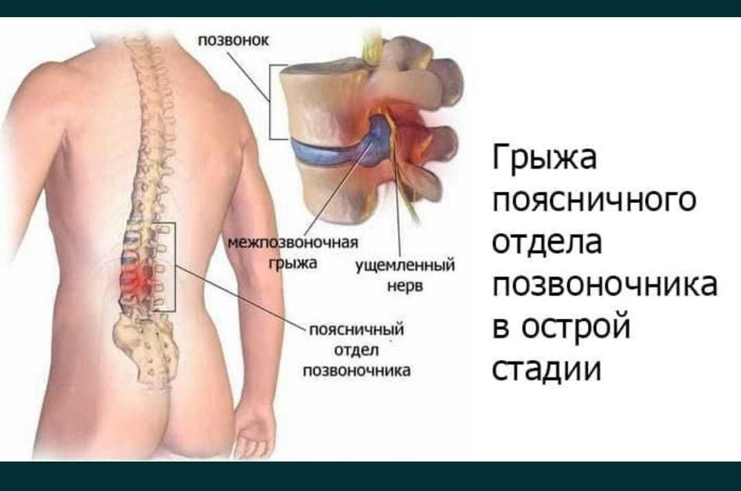 Подушка для коррекции и грыжи позвоночника