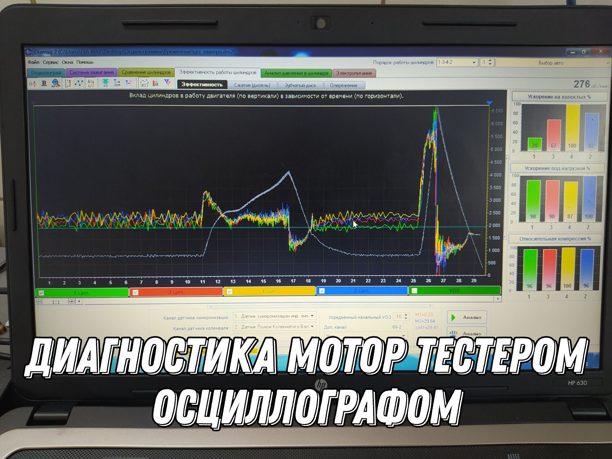 Чистка форсунок MPI GDI Hyundai Kia. Автоэлектрик. Диагностика.