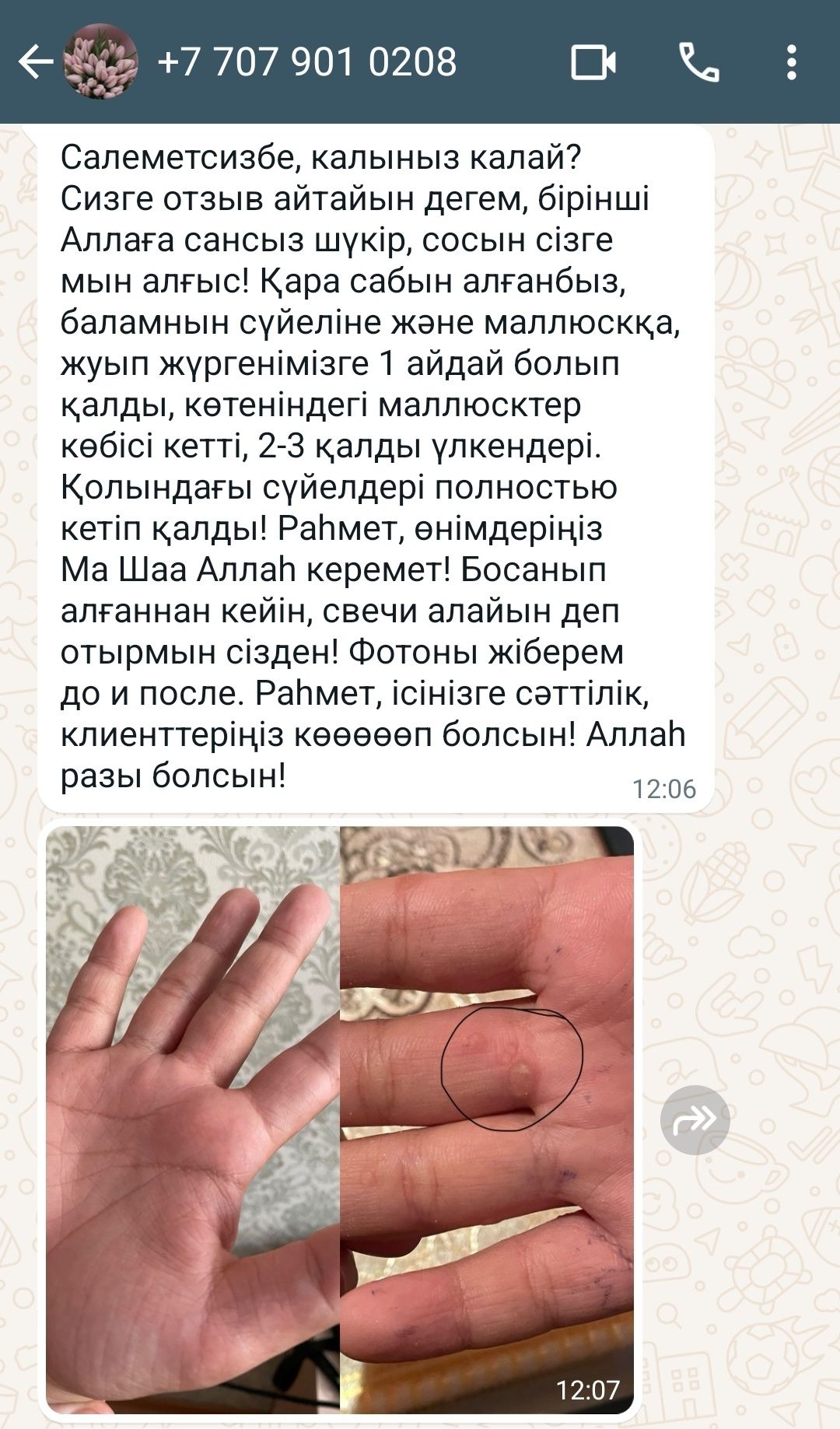 Тері аураларына қолдан қайнатылады