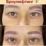 Броулифтинг по акции 80.000