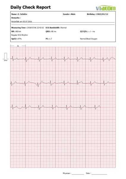 Checkme Lite Health Monitor, ЭКГ, пульсоксиметр, монитор здоровья