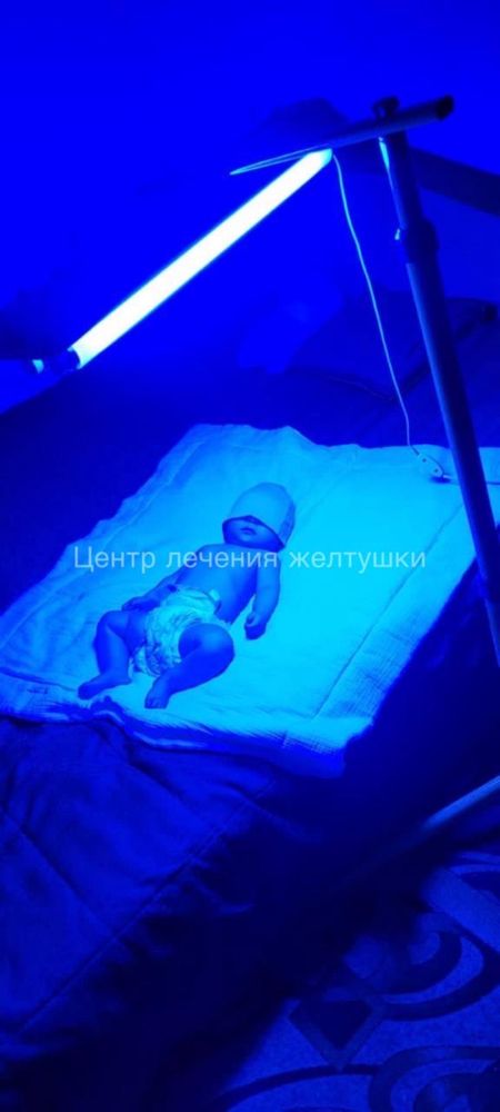 Фотолампа. Билитест. Фотолампа от желтушки