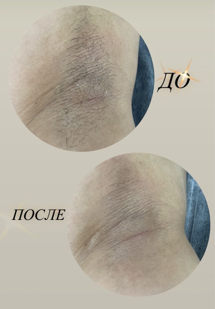 Приглашаю на курсы по шугарингу