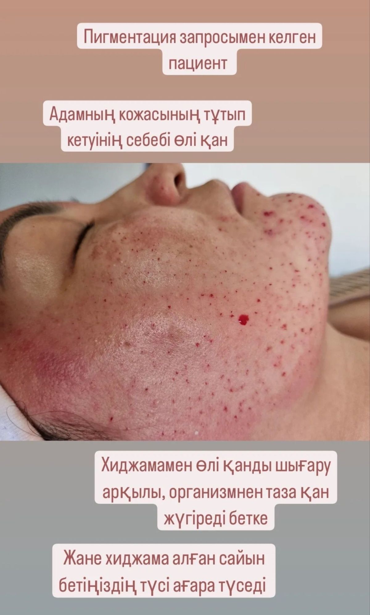 Емдик массаж, хиджама, жатыр массаж