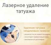 Удаление нежелательного татуажа.
