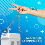 Удаление тату / татуажа лазером