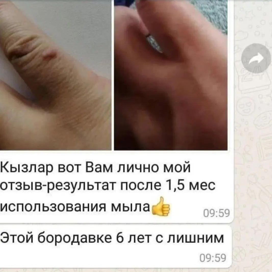 Лечебное Шунгитовое мыло