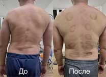 Невропатолог,мануальный терапевт,иглотерапия,остеопат,массаж,костоправ