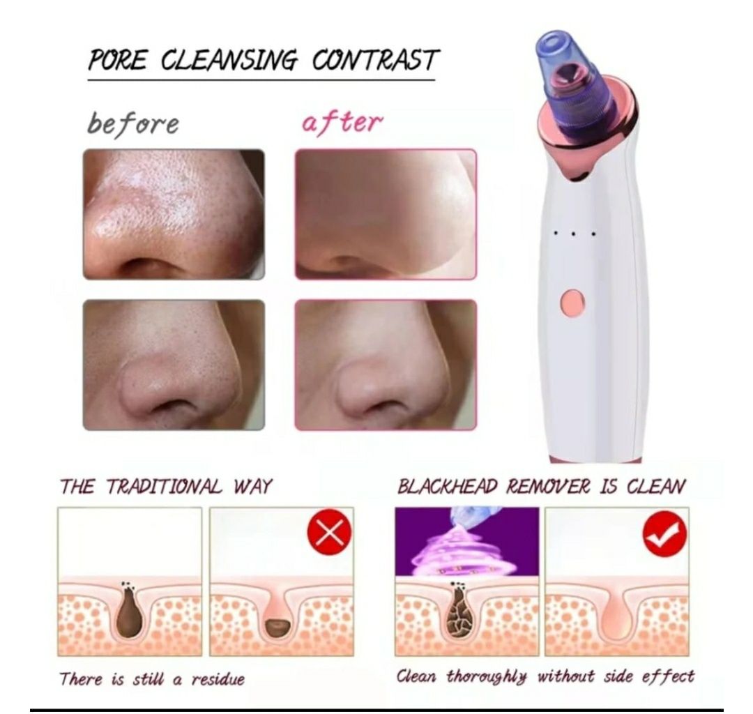 Аппарат Gezatone Vaku Silky Skin Вакуумный аппарат для чистки лица HY3