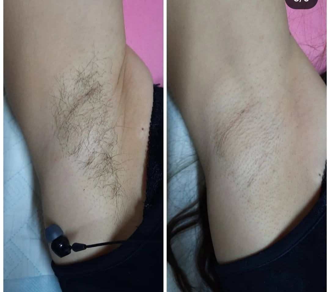 Шугаринг  всех зон только женский пол. Стаж 10 леОбучение шугарингу.