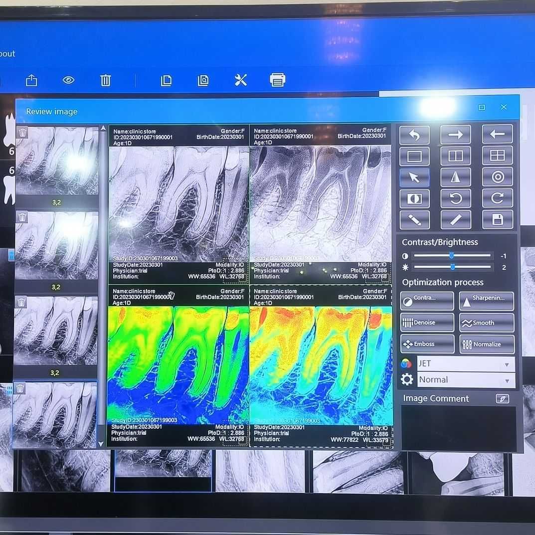 Комплект - Рентген аппарат XpectVision XVbeam2000 +  визиограф XVS2530