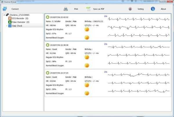 Checkme Lite Health Monitor, ЭКГ, пульсоксиметр, монитор здоровья