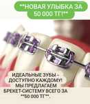 Установка брекет 50 000тг
Смеёшься пр
Тогда тебе к нам!!!