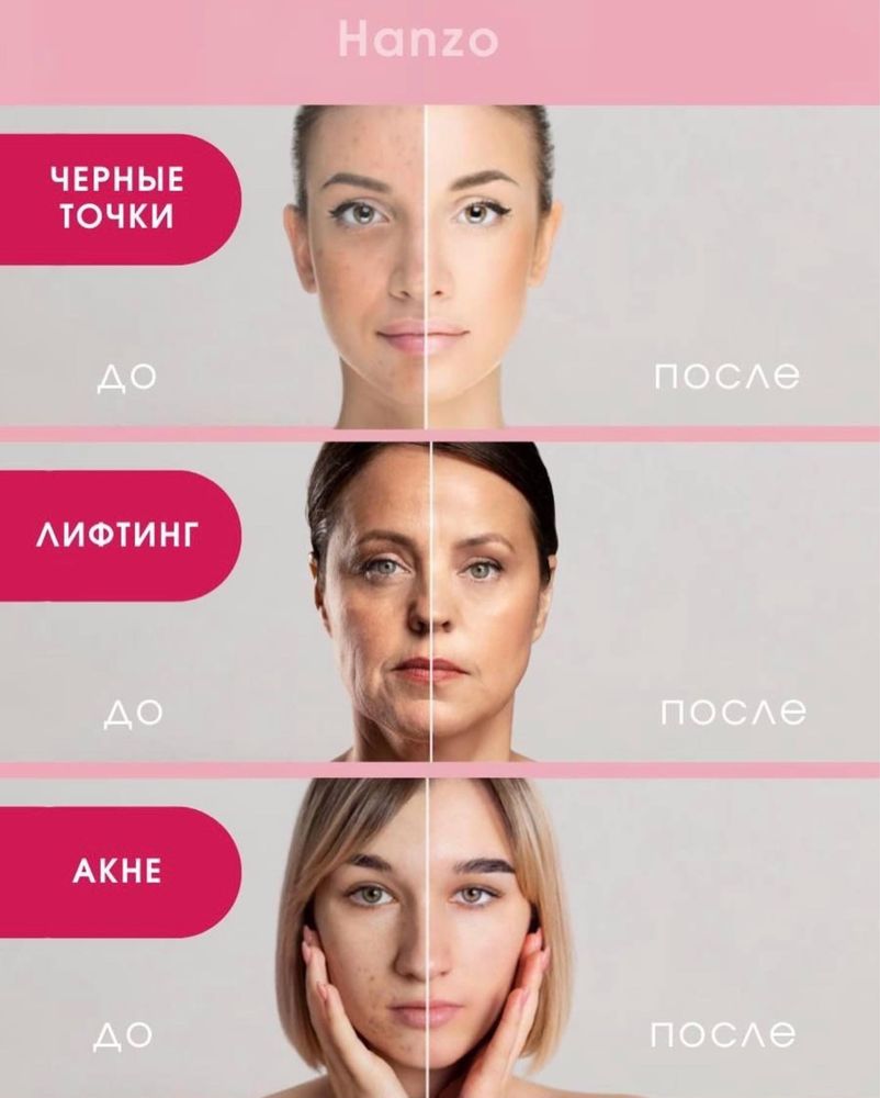 ультразвуковой аппарат по уходу за кожей лица