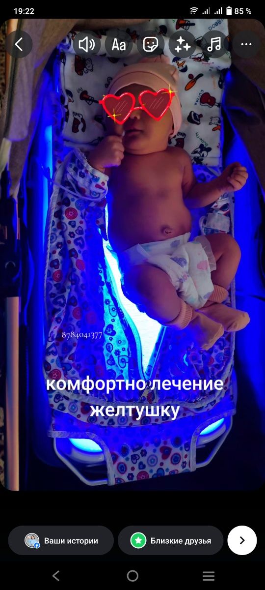 Фотолампа замер билурибин через кожу сарғыштану