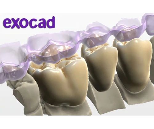 Exocad/ЗShape/Blender For Dental/BlueSkyPlan/Realgude/Invivo/Ezdent