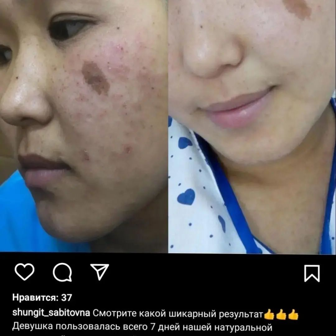 Лечебное Шунгитовое мыло