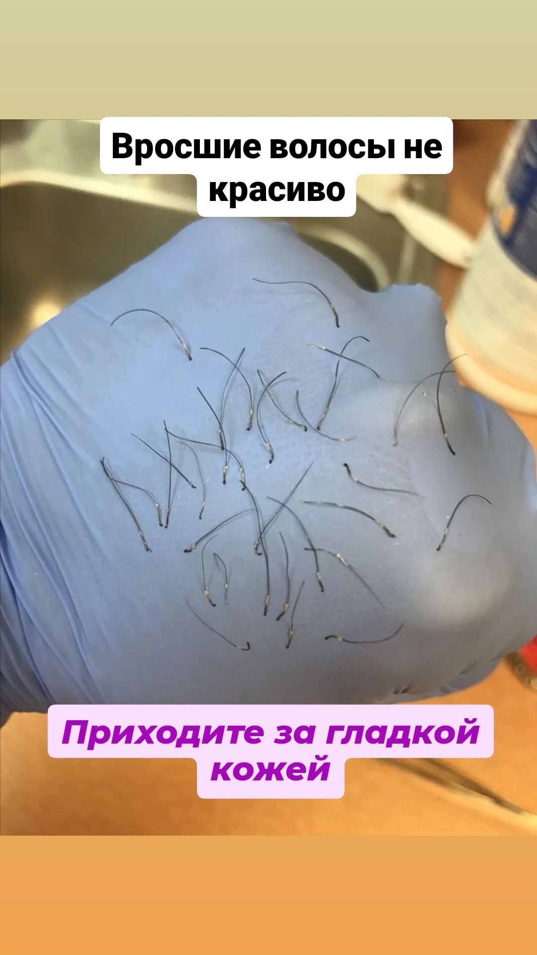 Шугаринг мужской