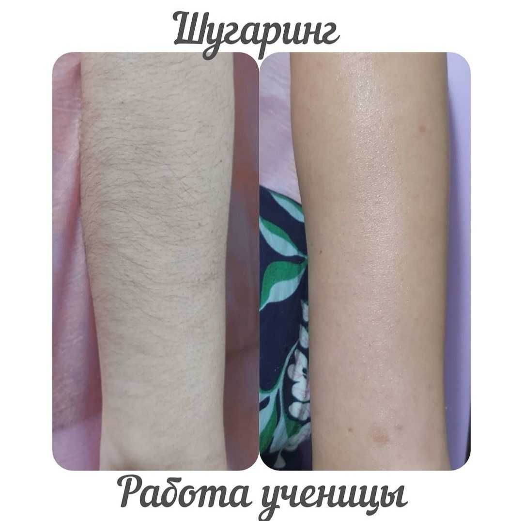 Обучение по Шугарингу по АКЦИИ