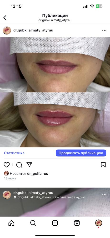 Нужны модели на губы 25.000тг