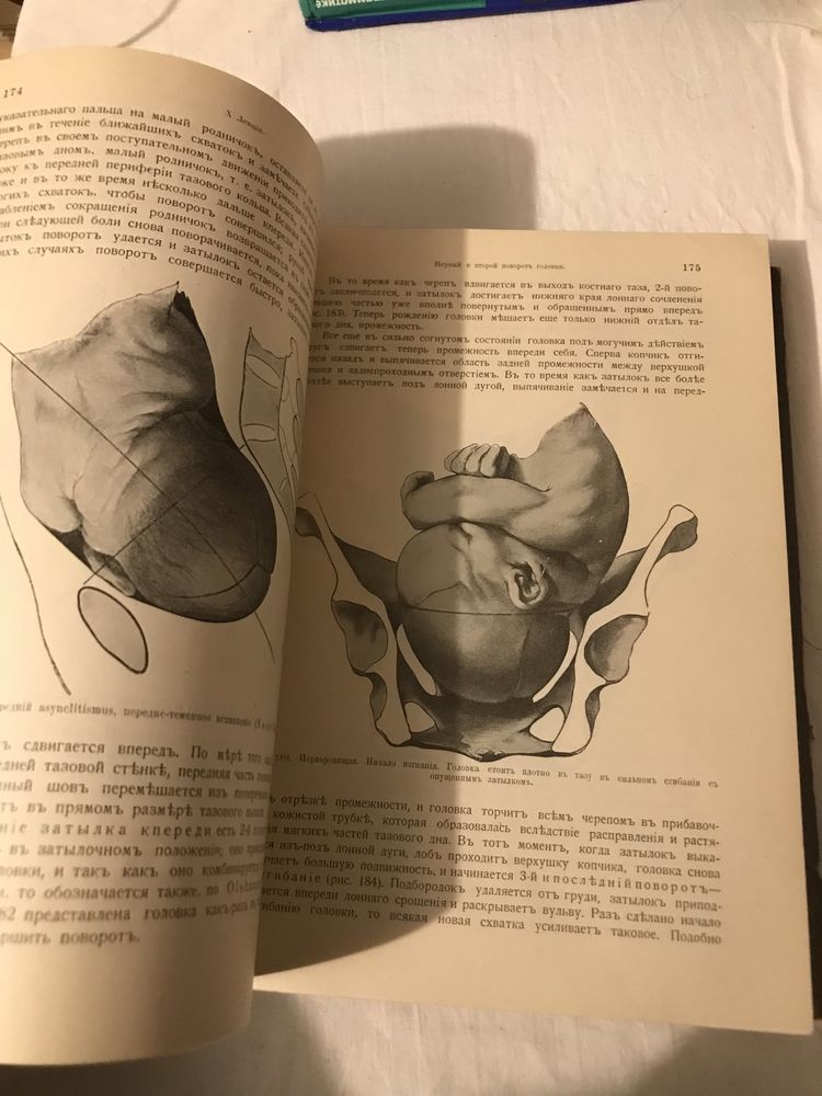 Е. Витт э: Руководство к изучению акушерства 1910 год антикварная книг
