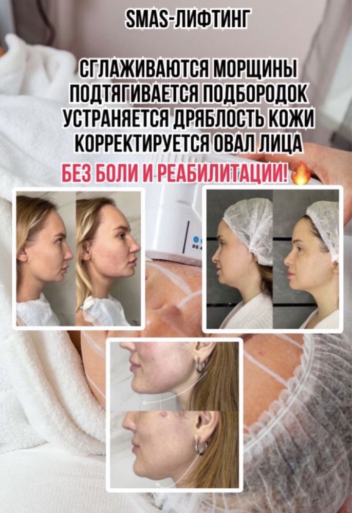Лазерная эпиляция, интимное омоложение, смас, чистка лица, коррекции