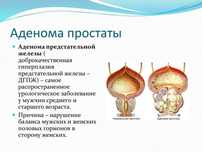 Урологиялық емдік массаж. Гемарройды операциясыз емдеу.
