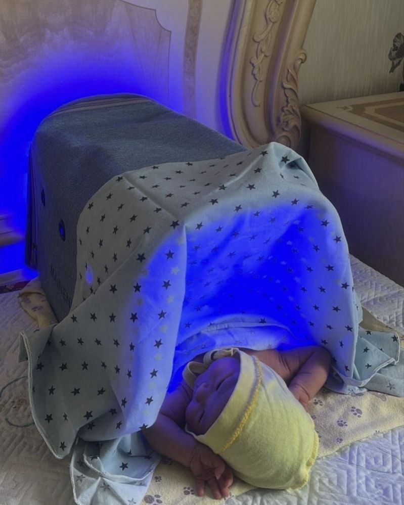 Аренда Новый Фотолампа от желтушки !