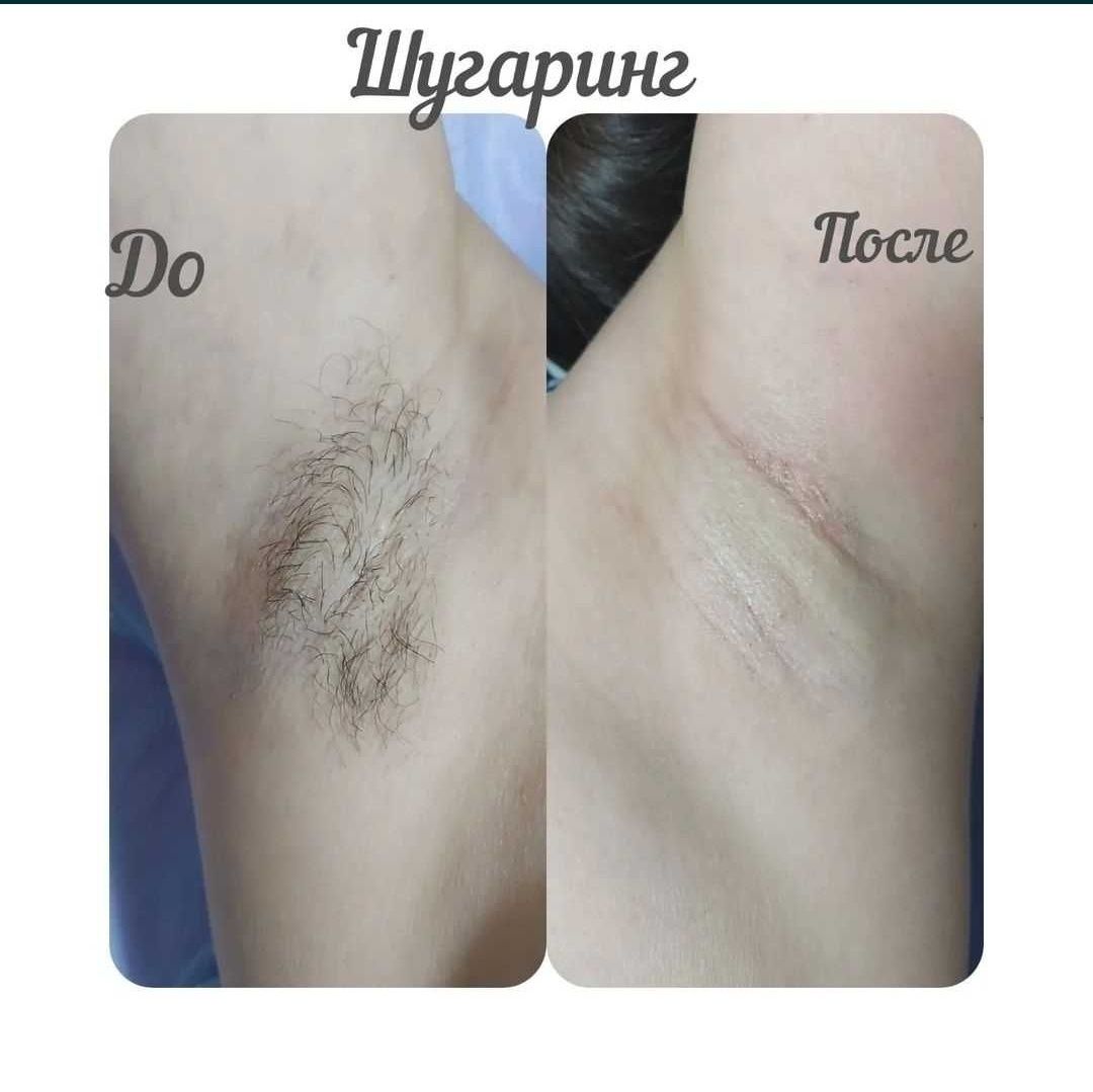 Курсы Шугаринга по Акции