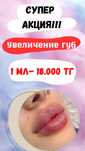 Шок цена! Акция! 18.000тг.Цена актуальна на 7 дней! На Увеличение губ!