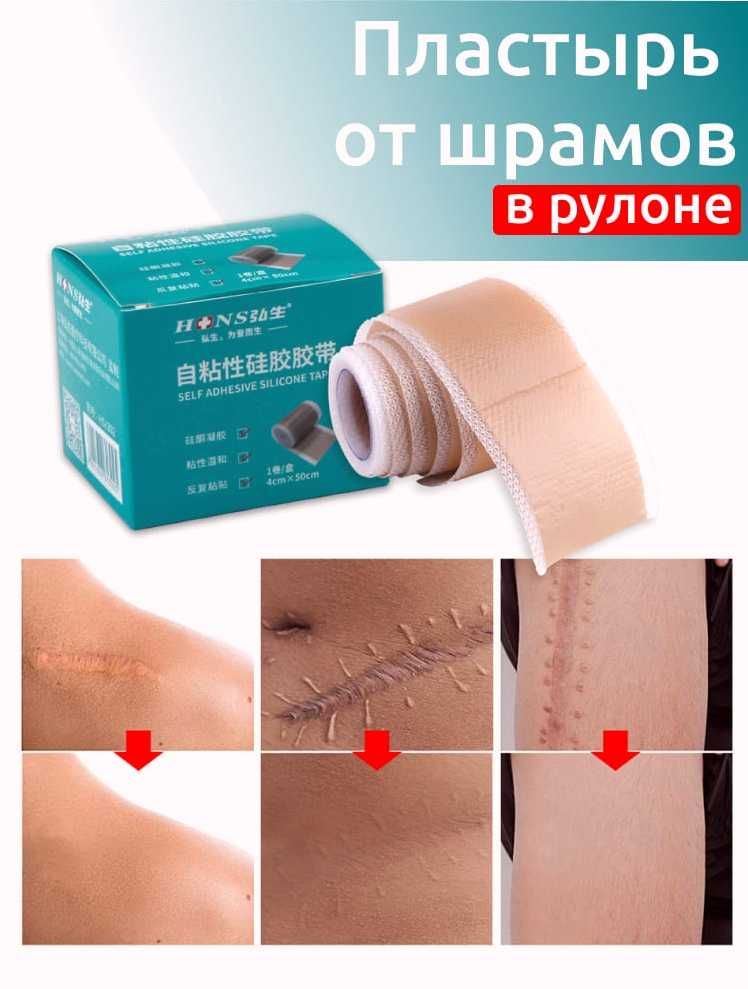 Лучший пластырь от шрамов, рубцов. Прост в применении