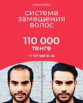 Система замещения волос для мужчин