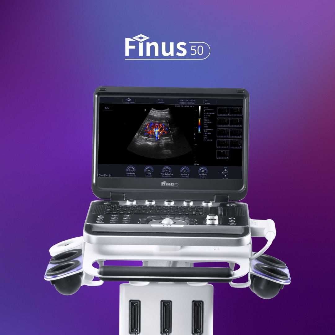 Finus 50 Портативный УЗИ аппарат высокого класса