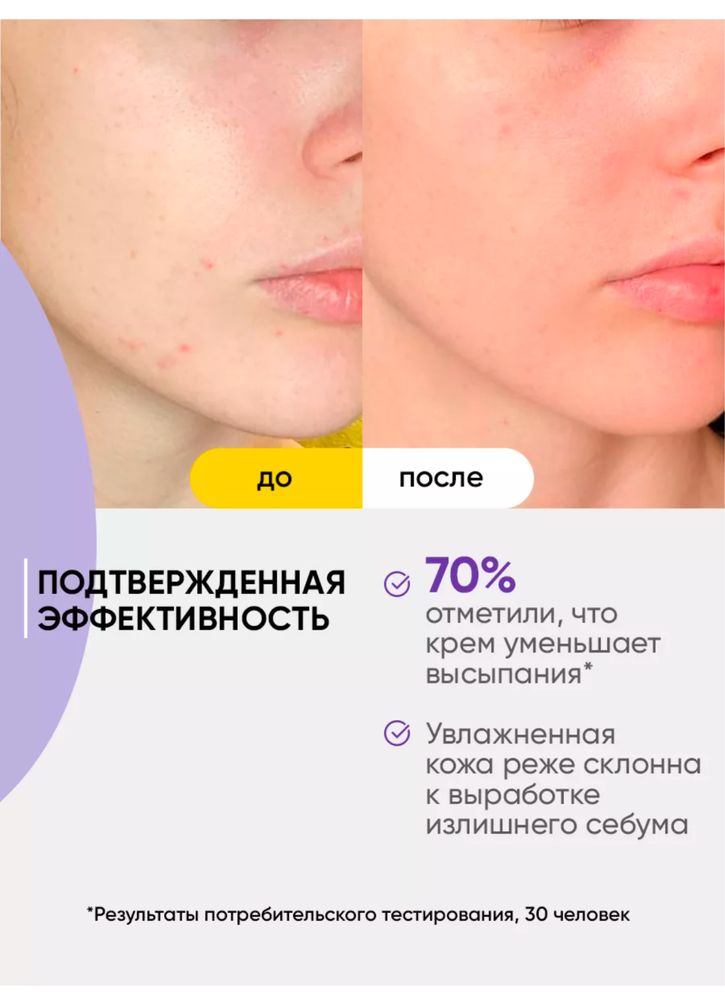 Крем Dr.Esthetica No Acne 50 мл против повышенной жирности кожи