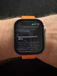 apple watch series 9 45mm starlight