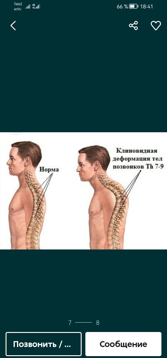 Ортопедический корректор осанки корсет