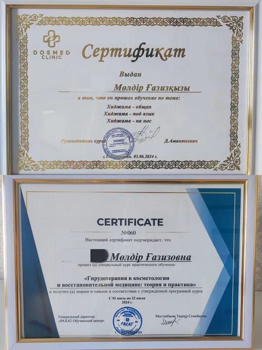 Оздоровительная Хиджама (Все виды), Лечение Пиявками (Гирудотерапия)