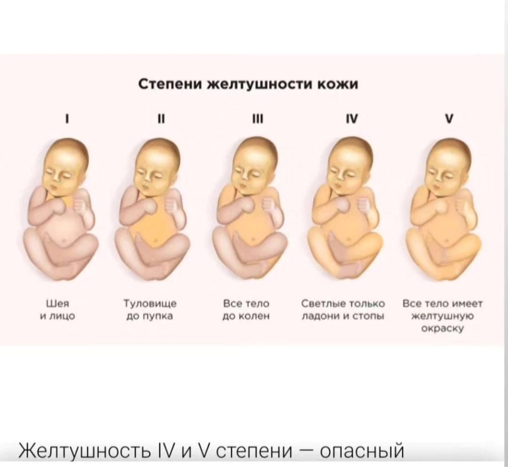 Фото лампа от желтухи