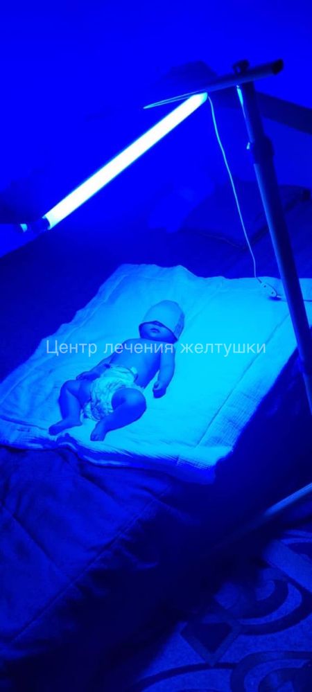 Фотолампа от желтушки