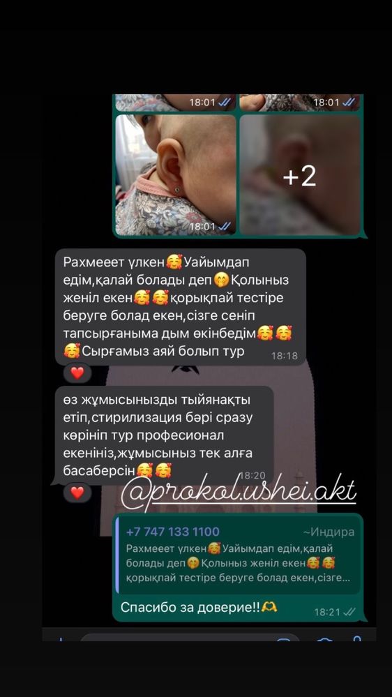 Прокол ушей Studex